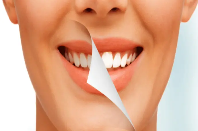 Blanchiment dentaire Blanchiment dentaire